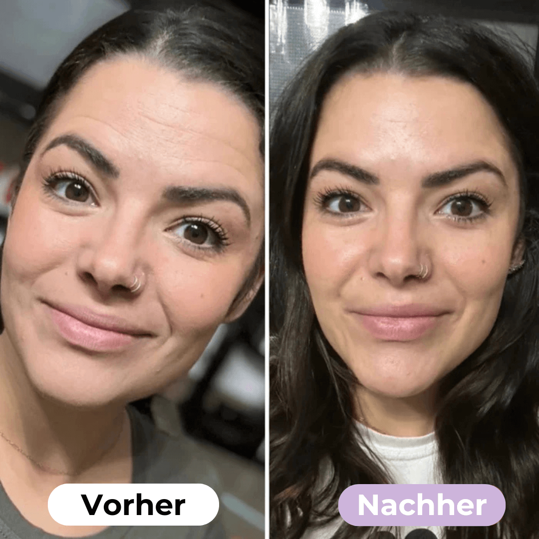 SmoothSkin™ Silikonplåster mot rynkor